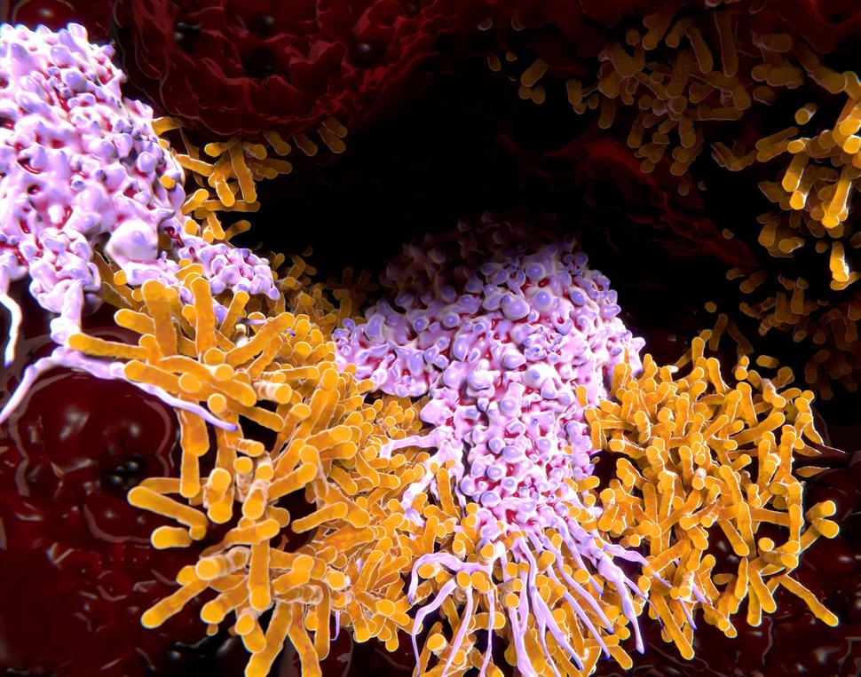 An illustration of an alveolar macrophage, in purple, attacking a bacterium, in orange. 